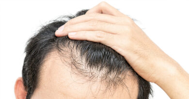 **କେଶ ଝଡ଼ିବା ରୋକିବା ପାଇଁ କିଛି ଟିପ୍ସ** means: **"Some tips to prevent hair fall"** 💇‍♀️🌿 Or more naturally: **"Tips to reduce and prevent hair loss"** ✨💆‍♂️🧴